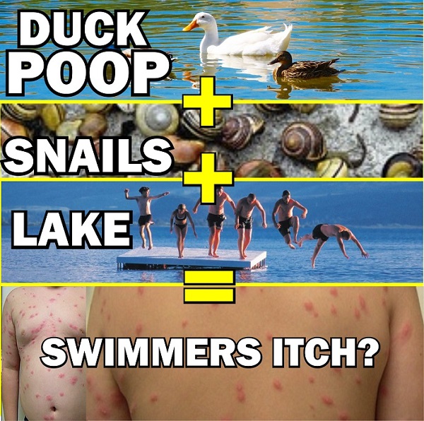 what lakes have swimmers itch in minnesota